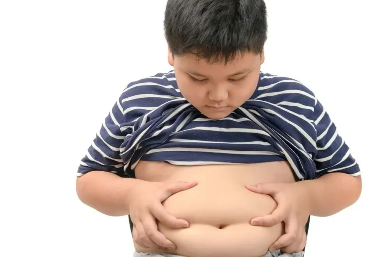 Childhood Obesity Causes, Risks, and Prevention-01